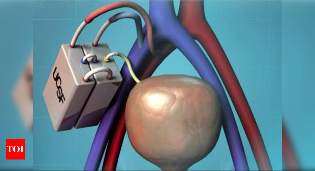 Artificial Kidney Artificial Kidney May Hit Market By End Of Decade India News Times Of India