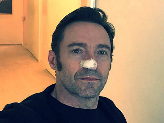 Hugh Jackman reveals that he is undergoing treatment for skin cancer