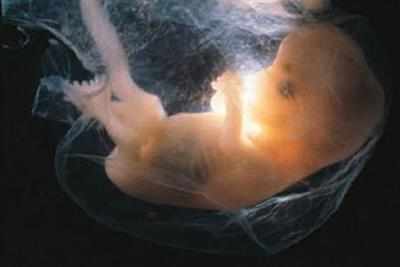 19 aborted female foetuses found dumped in Maharashtra's Sangli