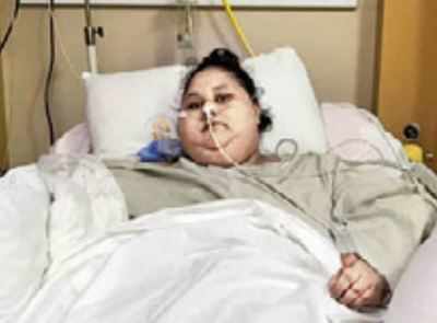 Surgery successful, doctors hope Eman will lose another 100kgs | Mumbai ...