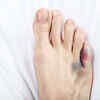 shoes tight at toes