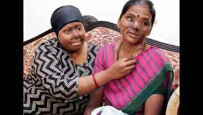 Acid attack survivor is a mentor, healer for others like her