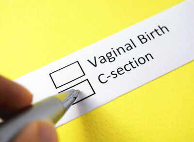 Myths about Caesarean deliveries busted