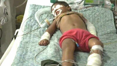 30 kids die in 48 hrs in Gorakhpur hospital