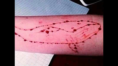 3 Kolkata girls suspected of being Blue Whale participants