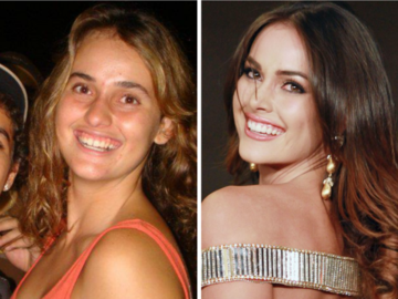 Top Beauty queens who did plastic surgery