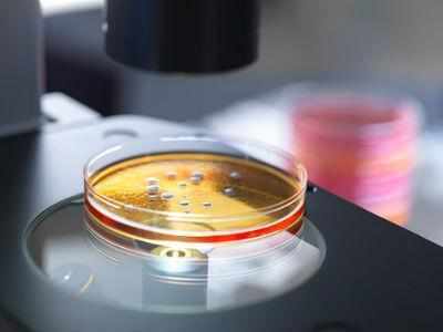 Dutch experts to study superbugs in India
