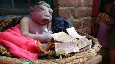 dead baby brain skull born without agra who farrukhabad district worshipped worshiped gestation period months being after india