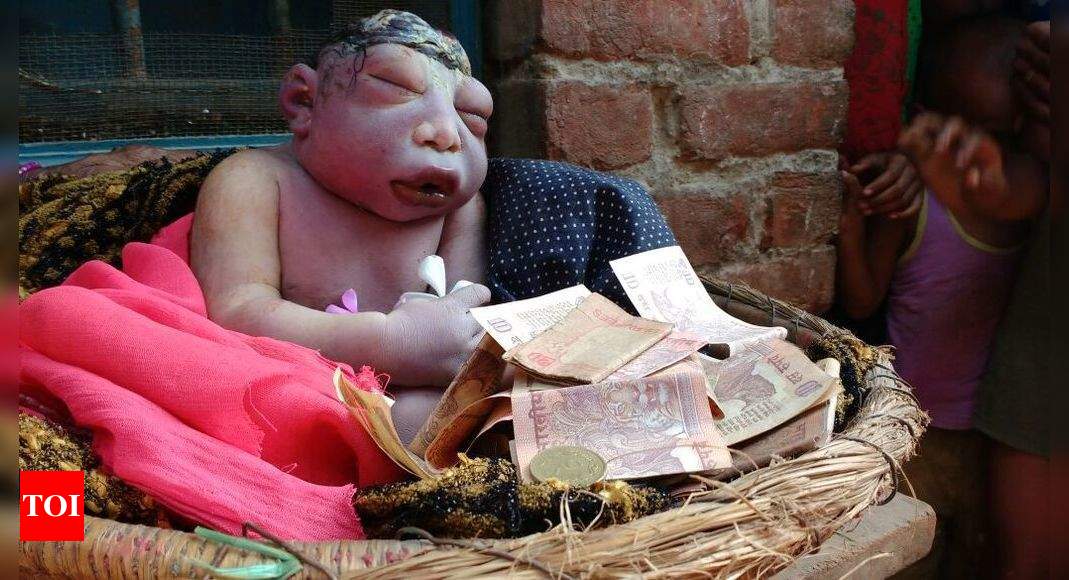 Farrukhabad: Brain Dead Baby Born Without Skull, Worshipped In ...