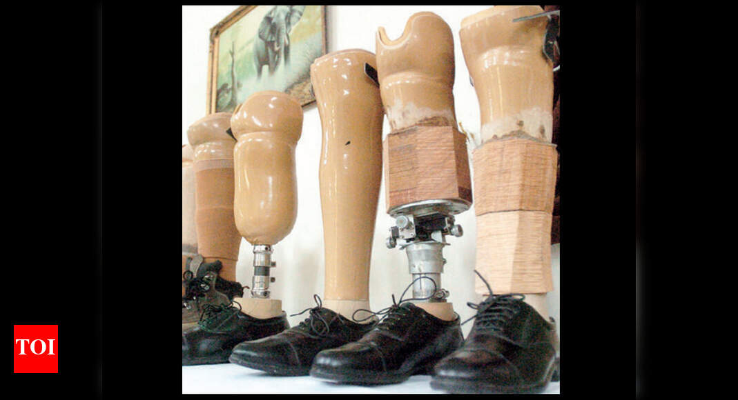 Artificial Limb Centre to undergo major overhaul Pune News Times of