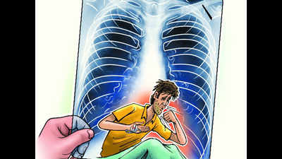 In Agra, 97 new TB patients found in 15 days
