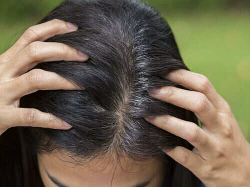 Grey Hair Home Remedies: How to get rid of grey hair, naturally Grey Hair Home Remedies: How to get rid of grey hair, naturally