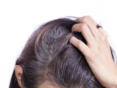 Grey Hair Home Remedies: How to get rid of grey hair, naturally Grey Hair Home Remedies: How to get rid of grey hair, naturally