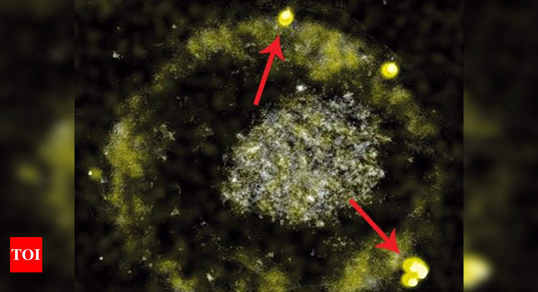 These Bacteria Digest Toxic Metals And Poop Out Tiny Gold Nuggets