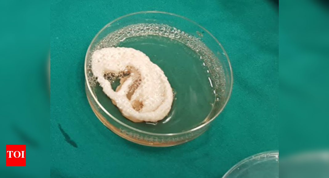 Chennai doctors, scientists grow ear in lab Times of India