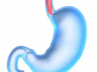 76% Kids And Teens In Up Have Worms In Stomach 