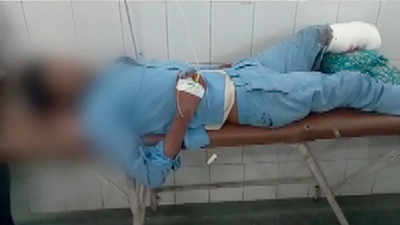 Jhansi hospital suspends 4 after doctors use amputated leg of accident victim as pillow