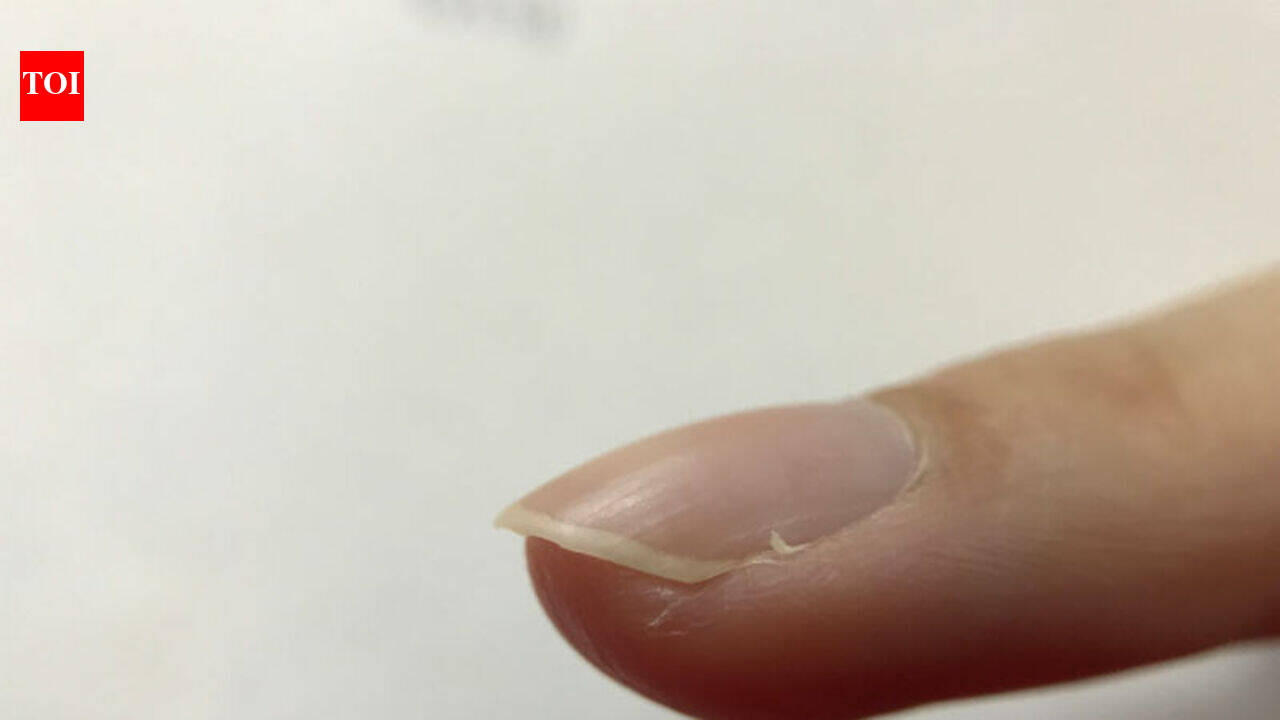 Why you should never rip off your hangnail