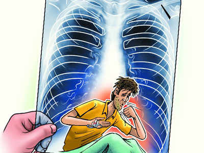 World TB Day: TB cases on a rise; show an increase of 200 from 2016 to 2017