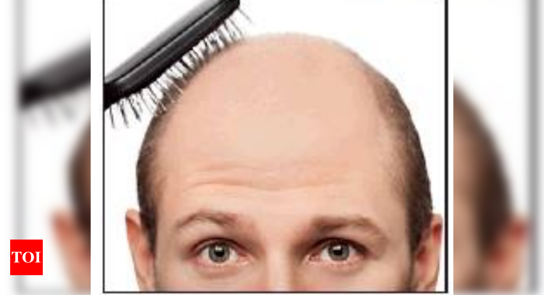 New cure for baldness on the way - Times of India