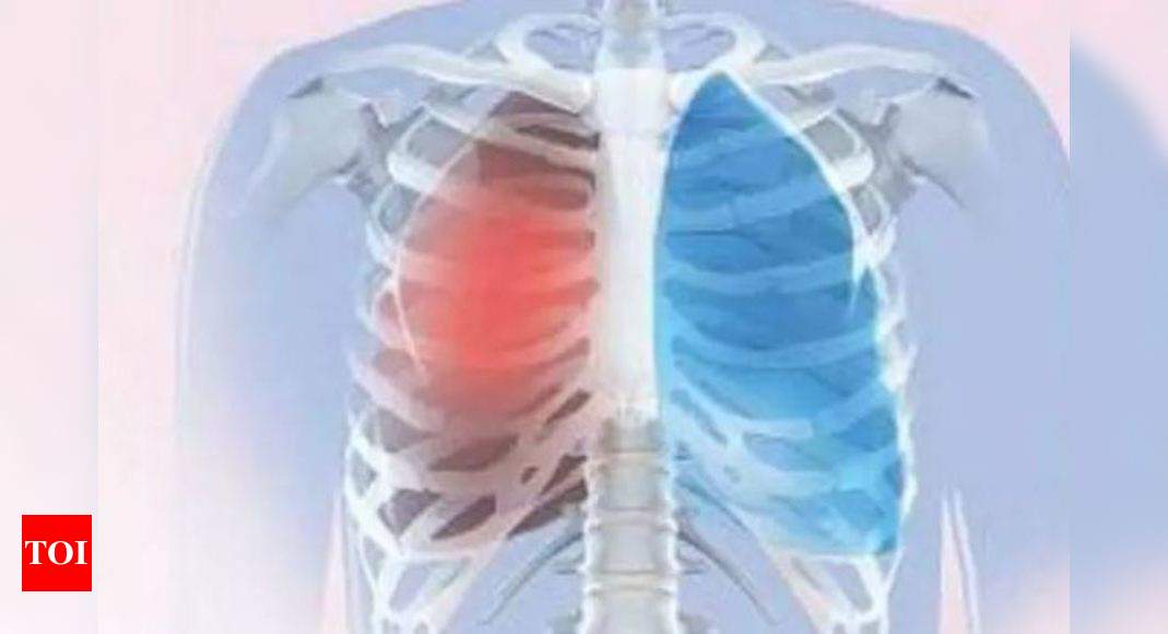 Deadly lung disease confused with TB, Asthma in UP | Lucknow News ...