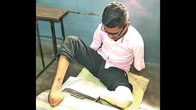 Boy with amputated legs, hands clears exam with flying colours