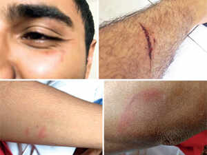 17-year-old boy seeks protection from his parents