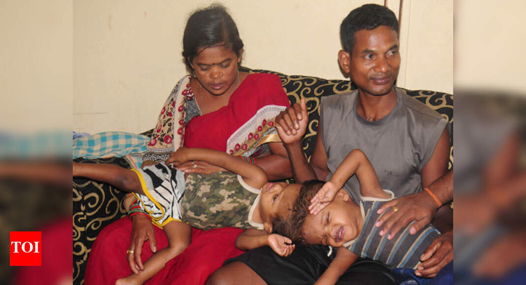 2 Sets Of Conjoined Twins Come To Aiims For Surgical Separation Delhi News Times Of India