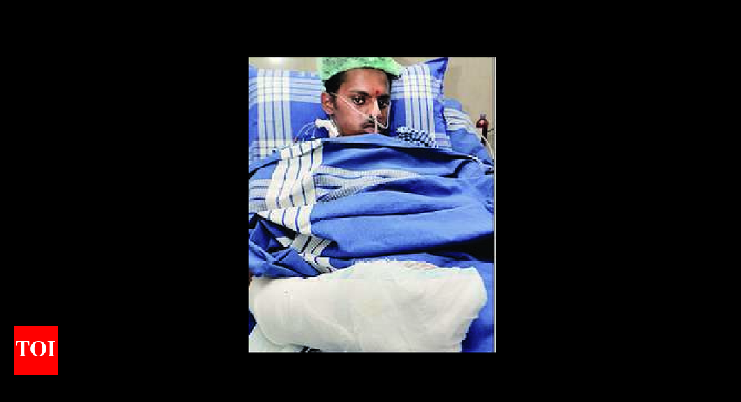 Youth’s chopped hand reattached in 12 hours Bengaluru News Times of