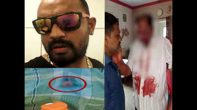 Horror in Bengaluru: Son gouges out father’s eyes for property