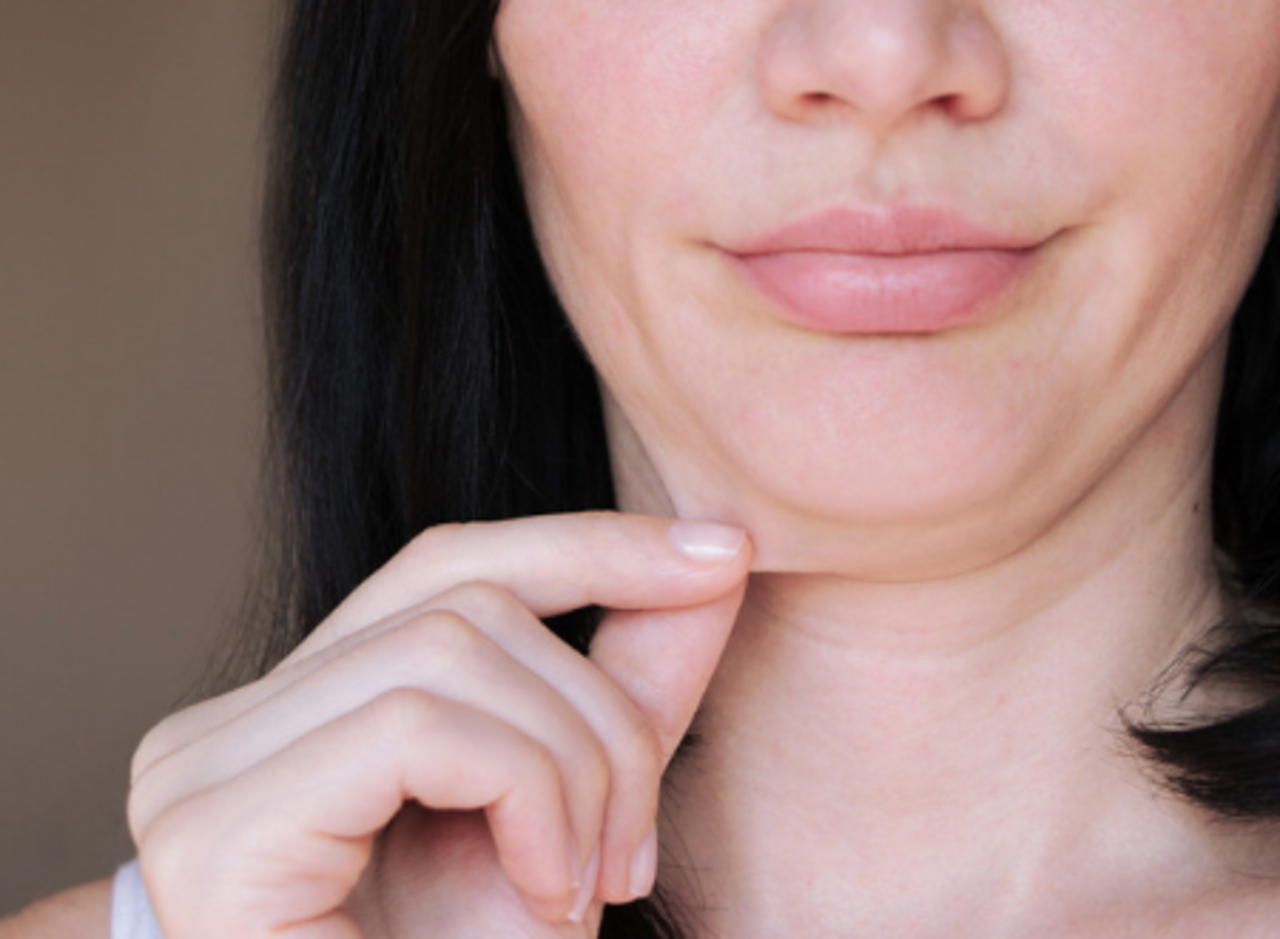 Pimples on the chin: What it means and how to get rid of them