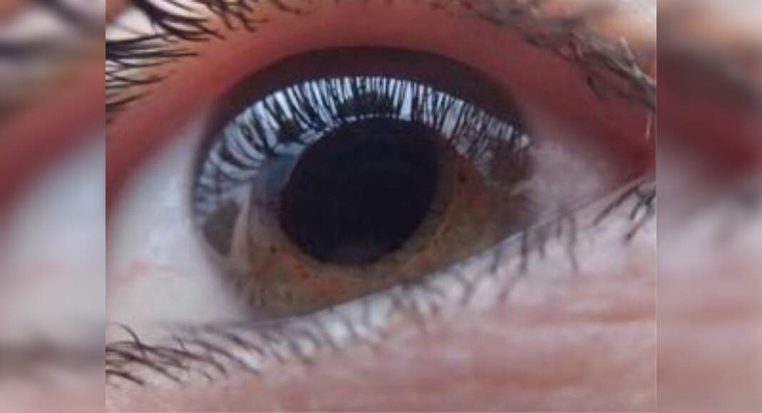 High doses of Viagra can cause severe damage to a person's colour ...