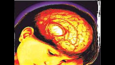 Madurai hospital doctors remove tumour from patient’s brain under local anaesthesia
