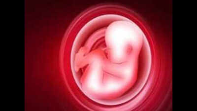 Spouses of pregnant women can be jailed for fetus sex test ...