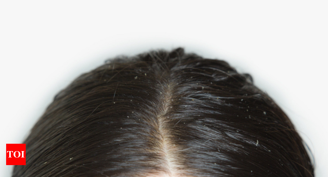 Hair Scalp Pain When You Do Not Wash it | Why Does Hair Hurt When it's  Dirty | - Times of India