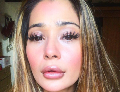 Sara Khan denies the botched lip job rumours, says she's loving it