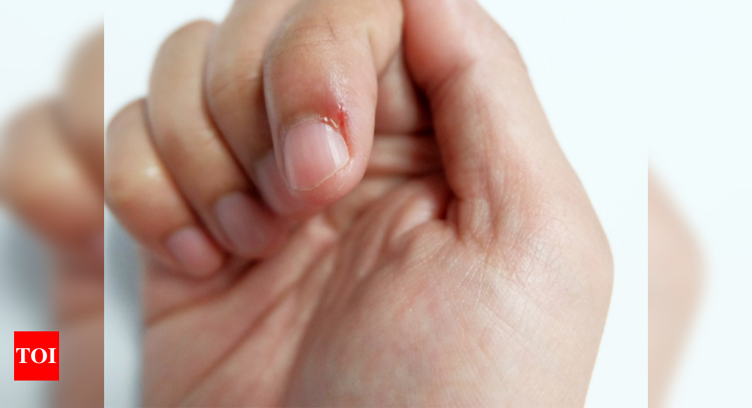 Why do people bite their nails? Am expert weighs in on the condition