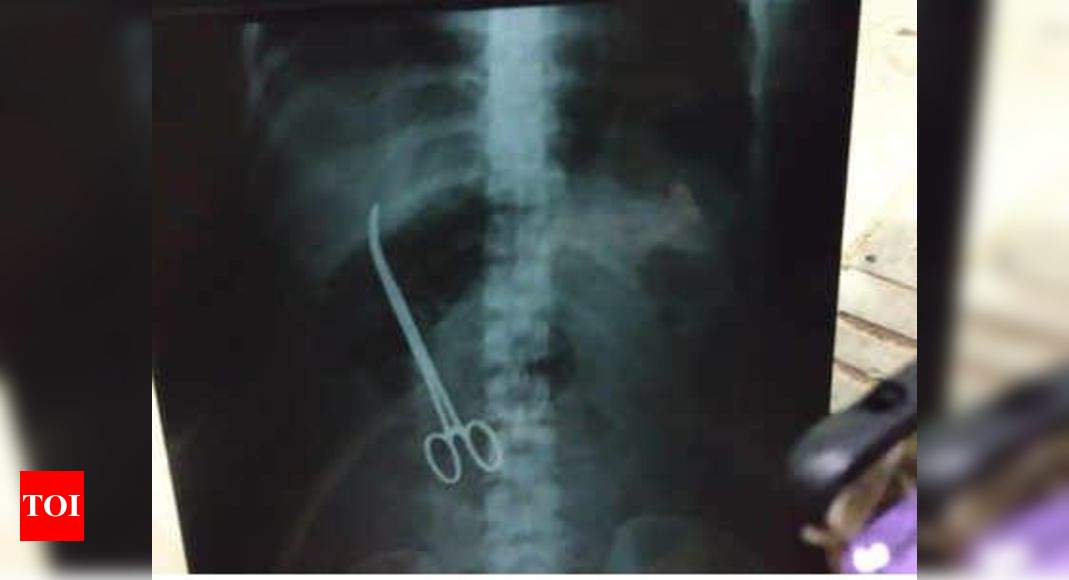 Nims Doctors Leave Scissors Inside Patients Stomach Remove It After 3 Months Hyderabad News