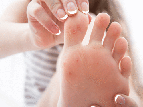 Home Remedy to Get Beautiful Feet: How soaking your feet in