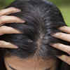 Got Grey Hair These 5 Home Remedies Can Work Better Than Hair Dyes And Hair  Colours