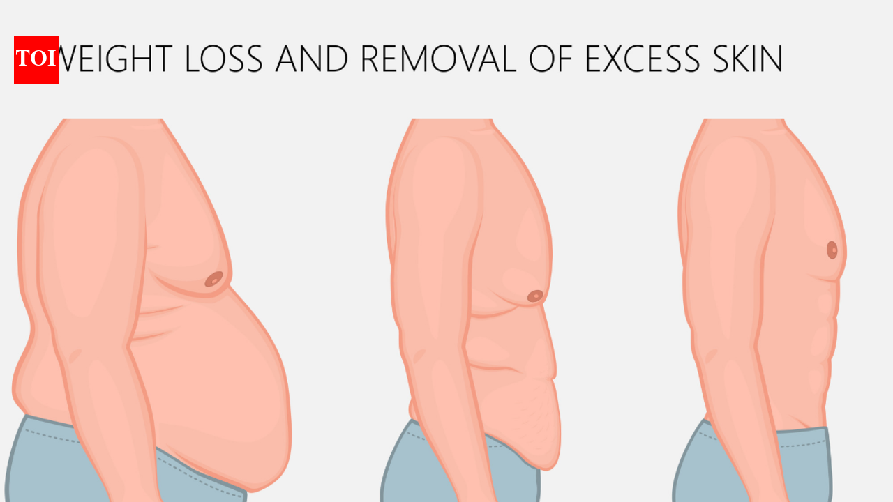 Tighten Loose Skin After Weight Loss | How to get rid of excess skin ...