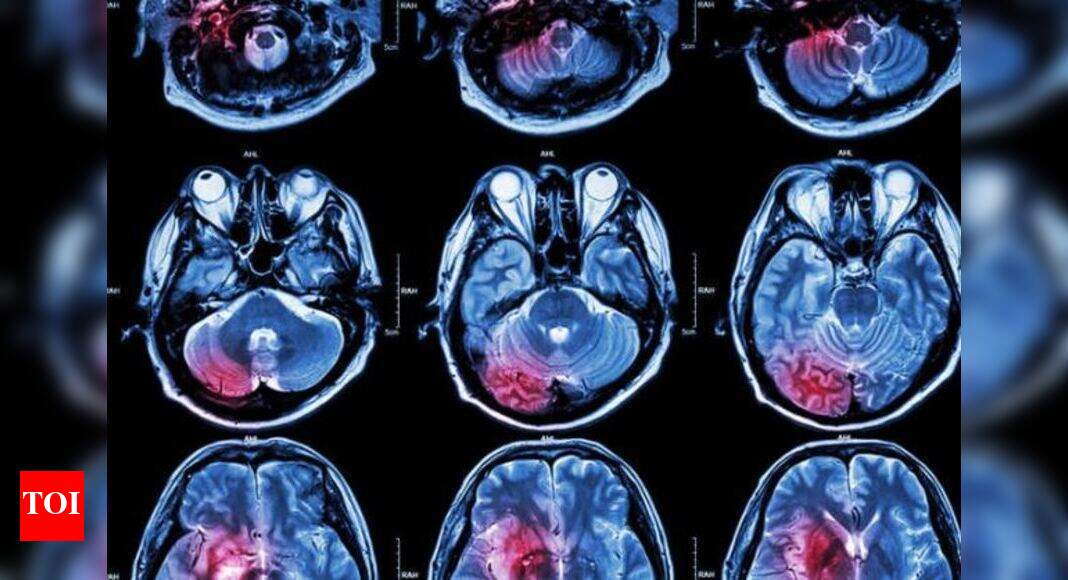 New optical imaging system to help find tiny tumours Times of India