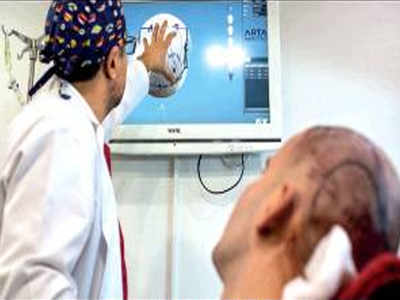 Hair transplant death: Man wanted more grafts in 1 go?