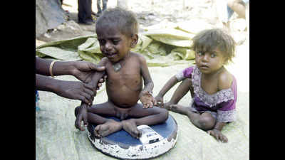 Udham Singh Nagar home to 39.5% malnourished children