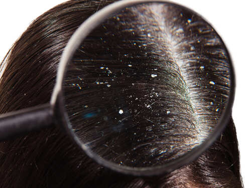 Sleeping with Wet Hair Side Effects: What Happens When You Sleep With Wet Hair? Sleeping with Wet Hair Side Effects: What Happens When You Sleep With Wet Hair?