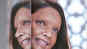 Deepika Padukone's first look as acid attack survivor in ‘Chhapaak’ is out