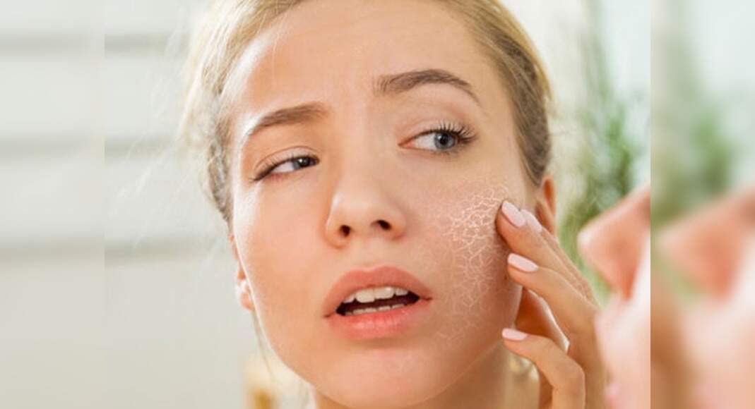 Best Ways To Treat Dehydrated Skin