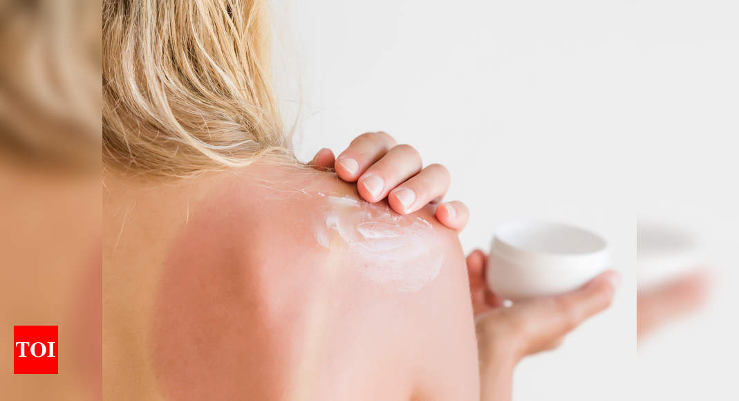 Natural Sunburn Relief Cream - Creating a Simple, Natural, and
