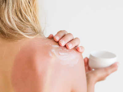 Quick home remedies for sunburn relief