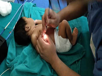 Kolkata scientists invent no-needle device for newborn path tests